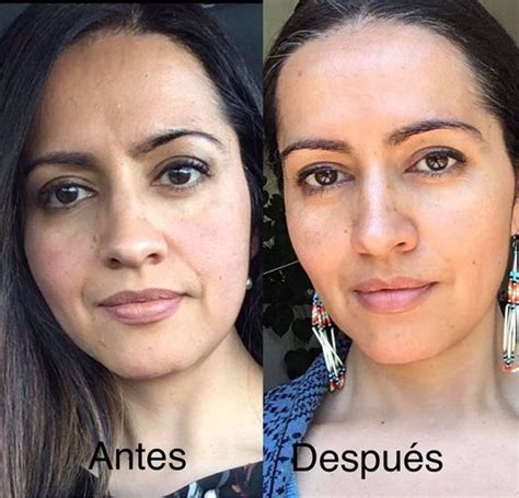 gimnasia facial antes despues